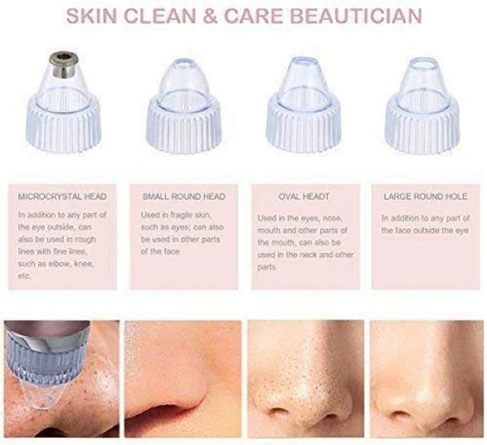 Nestora Pore Cleaning Device – Blackhead Remover Vacuum Suction, Skin Care Tool